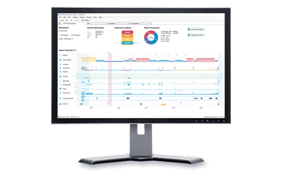 Noxturnal opdatering NoxA1s