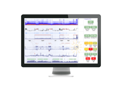 Noxturnal opdatering NoxA1s